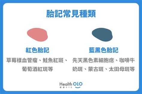 手上胎記|胎記怎麼產生、何時消除？醫師剖析胎記種類、胎記寓意